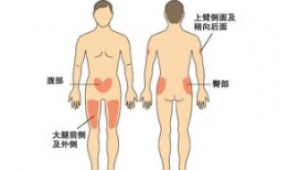 胰岛素打肚子视频教程,轻松掌握腹部注射技巧